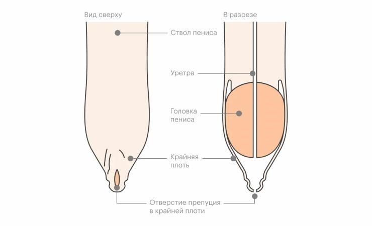 вид пениса до обрезания