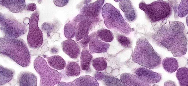 Микоплазмоз