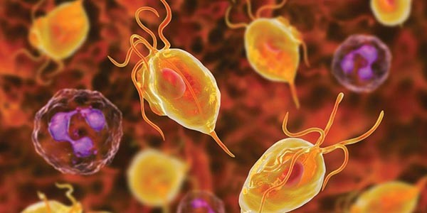 Трихомониаз