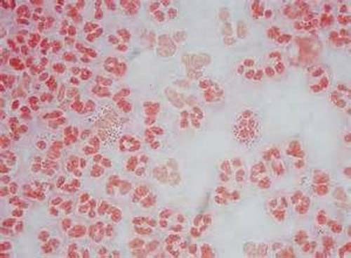 Венерическая гранулема